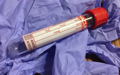 Understanding blood and urine tests